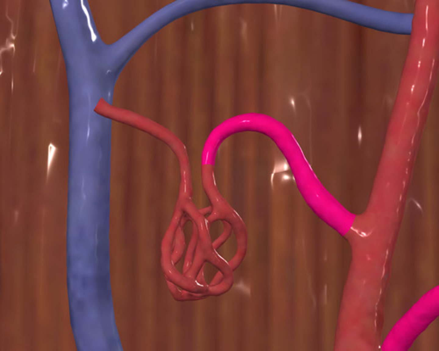 <p>ID Vessel Highlighted Pink</p>