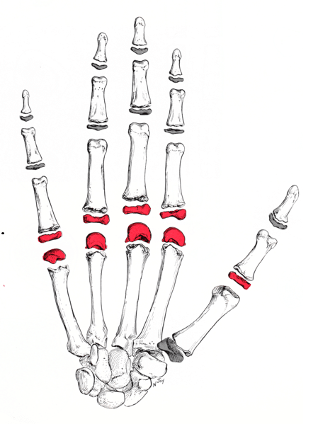 <p>MCP joints</p>
