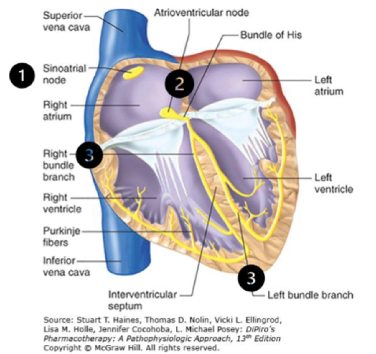 <p>• Electrical impulse starts at the sinoatrial (SA) node of the right atrium</p><p>• Then a wave of depolarization occurs across the atria to the atrioventricular (AV) node</p><p>• Conduction goes down the left and right bundle branches, and into the His-Purkinje system where it transmits to the ventricular myocardium</p><p>• The electrical stimulation of heart muscle cells cause calcium to enter into the cell, more calcium is released causing a contraction</p><p>• After the contraction, myocytes repolarize and get ready for the next impulse</p>