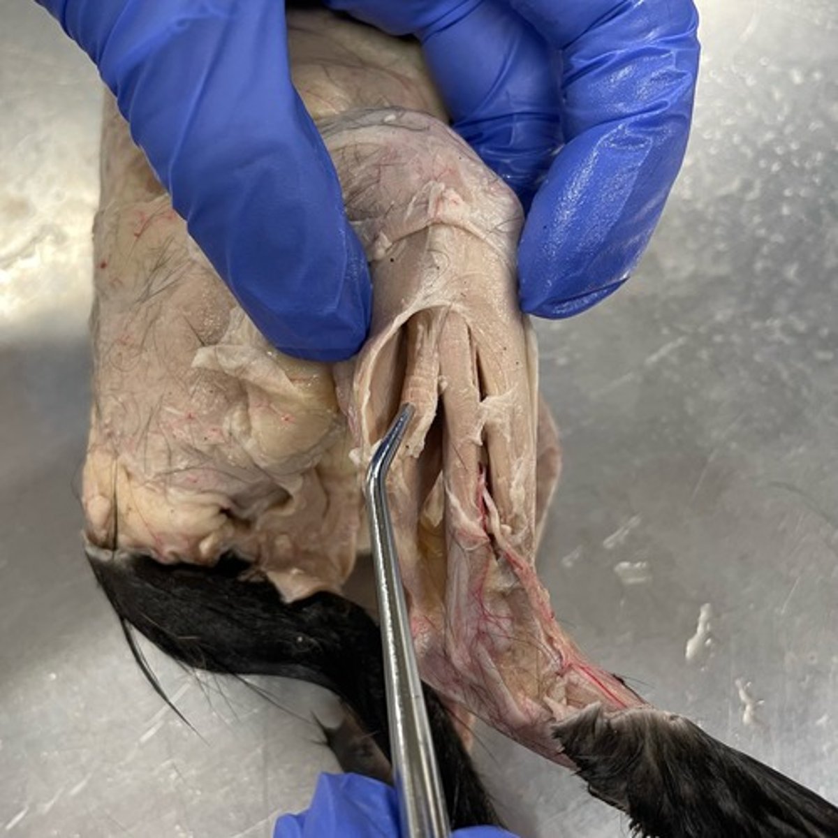 <p>O: tibia; fibula</p><p>I: calcaneus via the calcaneal tendon (achilles tendon)</p><p>A: plantar flexion</p>