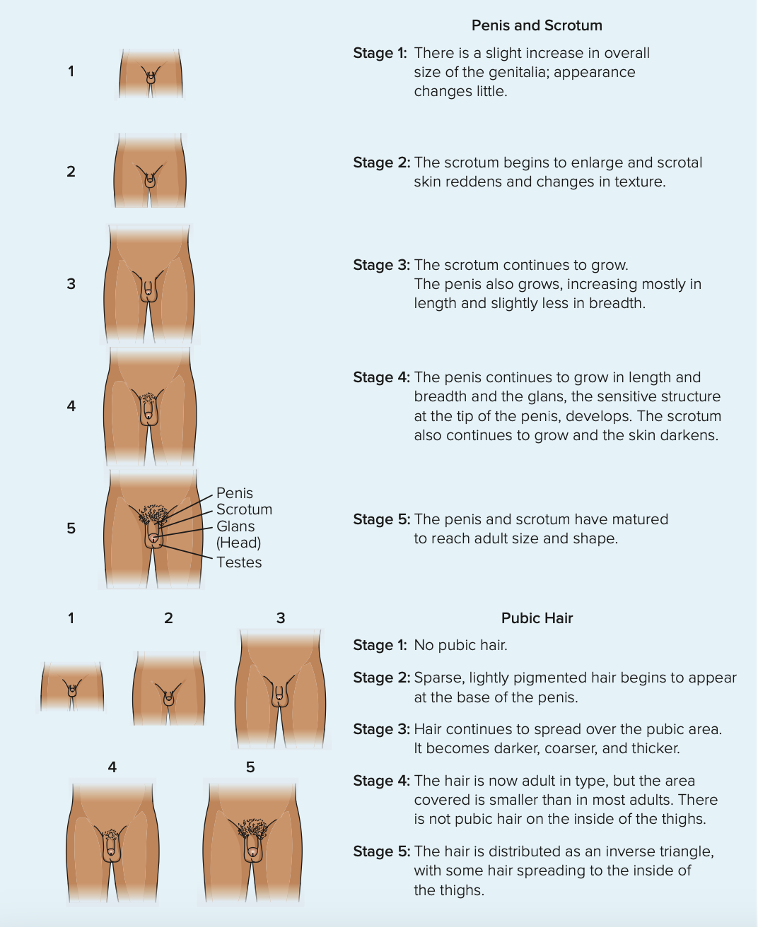 <ol><li><p>Growth of testicles, scrotum</p></li><li><p>Growth of pubic hair</p></li><li><p>Body growth</p></li><li><p>Growth of penis + Change in voice</p></li><li><p>Facial and underarm hair + acne</p></li></ol><p></p>