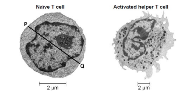 <p></p><p>The figure below shows electron microscope images of the two types of cell.</p><p>State one feature that shows the images in the figure in part (a) were taken with an electron microscope and not an optical microscope. Explain your answer. (2) </p>