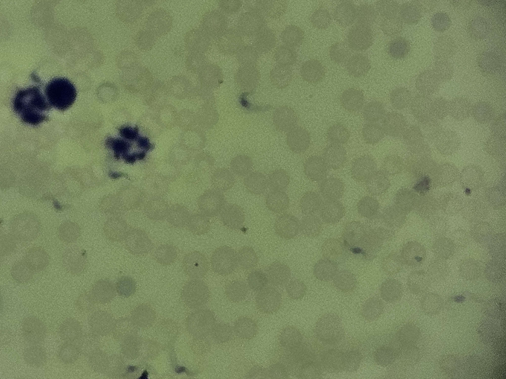 <p><span data-name="microscope" data-type="emoji">🔬</span><span data-name="petri_dish" data-type="emoji">🧫</span><strong><span> </span>Na podstawie zdjęcia preparatu:</strong></p><p></p><ul><li><p><span data-name="book" data-type="emoji">📖</span><span> </span>rozpoznaj gatunek pasożyta;</p></li></ul><p></p><ul><li><p><span data-name="recycle" data-type="emoji">♻</span><span> </span>rozpoznaj wszystkie formy rozwojowe;</p></li></ul><p></p><ul><li><p><span data-name="microbe" data-type="emoji">🦠</span><span> </span>wskaż organelle i cechy charakterystyczne dla danego gatunku;</p></li></ul><p></p><ul><li><p><span data-name="mask" data-type="emoji">😷</span><span> </span>nazwij chorobę, którą pasożyt wywołuje.</p></li></ul><p></p>