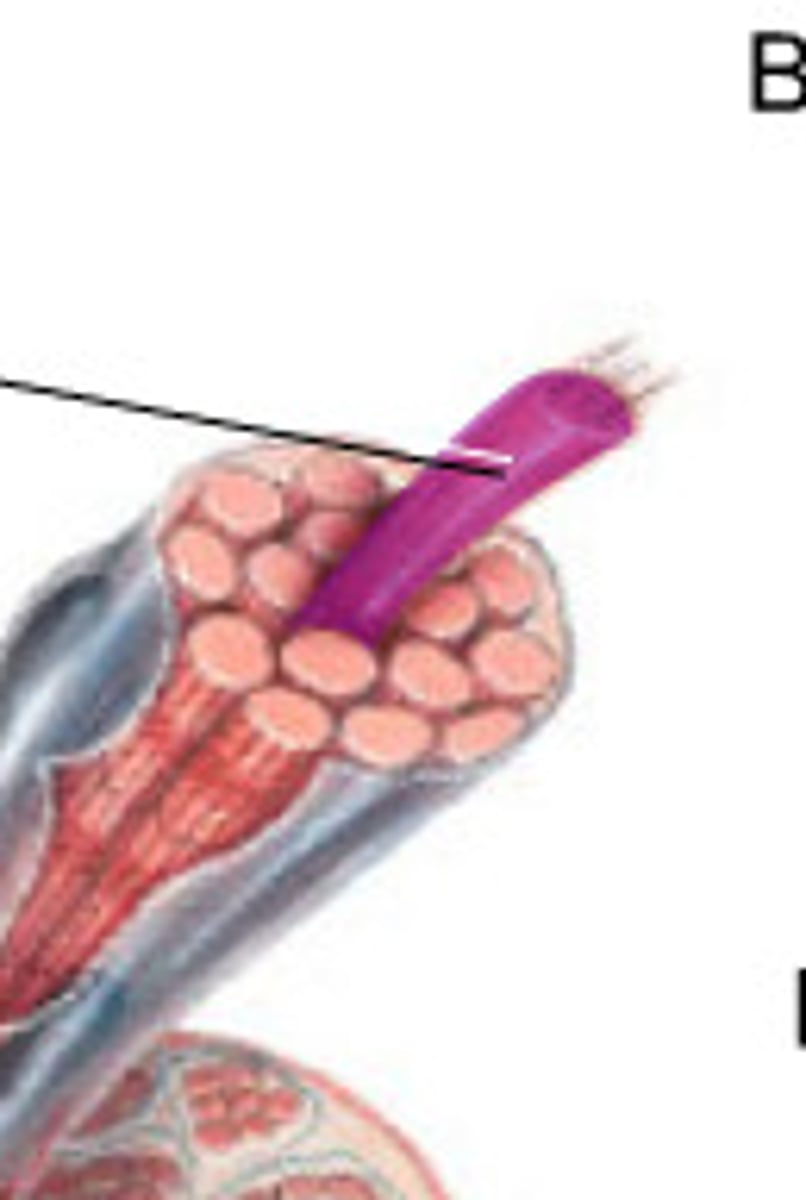 <p>Made of many sarcomere sub-units and is a strand which runs the length of a muscle fiber</p>