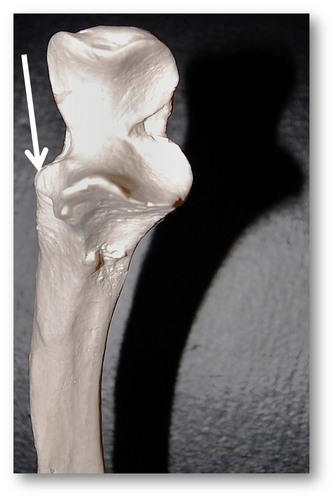 Name this specific part of the ulna.