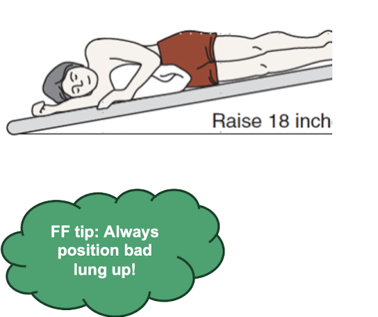 <p>Practice Q 2: </p><p>A clinician is educating the patient's parents on postural drainage. The clinician places the patient in a position, as shown in the image below. Which of the following segments of the lungs is MOST LIKELY being drained?</p><p>A. Right lateral basal segment</p><p>B. Right middle lobe</p><p>C. Left lingular segment</p><p>D. Left lateral basal segment</p>