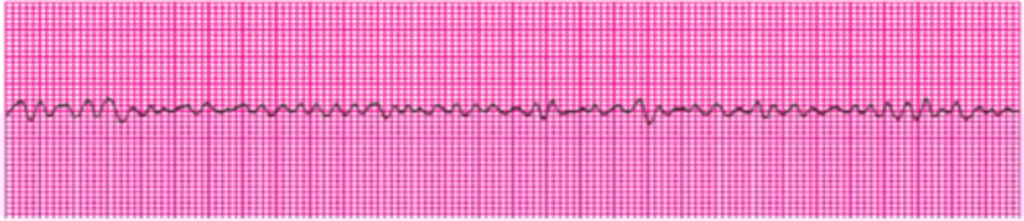 <p>Name this rhythm.</p>