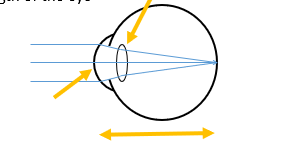 <p>Shape of the cornea  Power of the cornea</p><p>Power of the lens</p><p>Length of the eye</p><p></p>