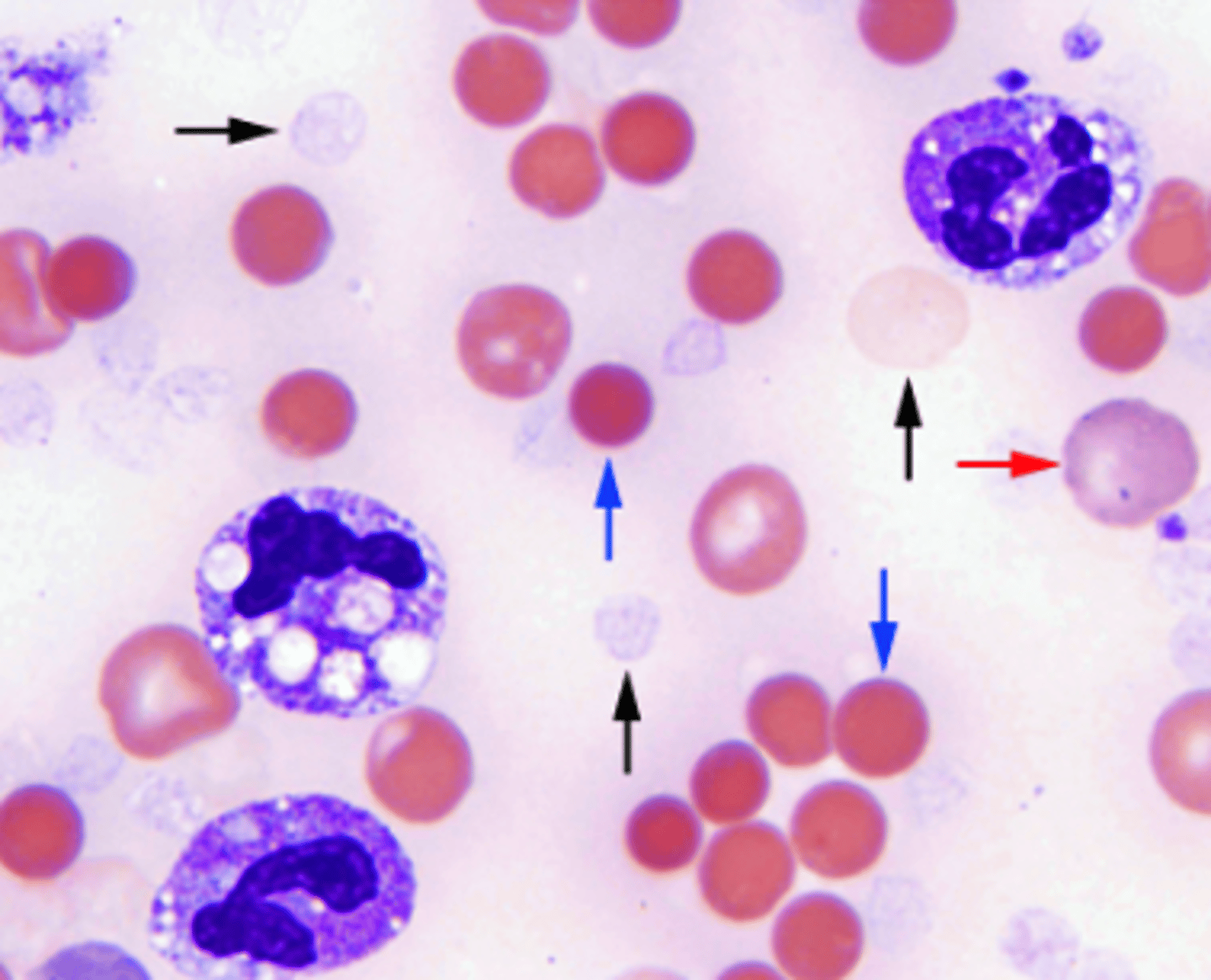 <p>blood smear of C. perfringens show</p>