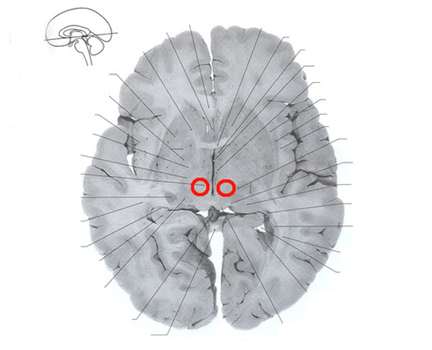 <ul><li><p>in midbrain</p></li><li><p>receives inputs from the cerebellum and motor cortex</p></li><li><p>sends axons to motor neurons in the spinal cord</p></li></ul><p></p>