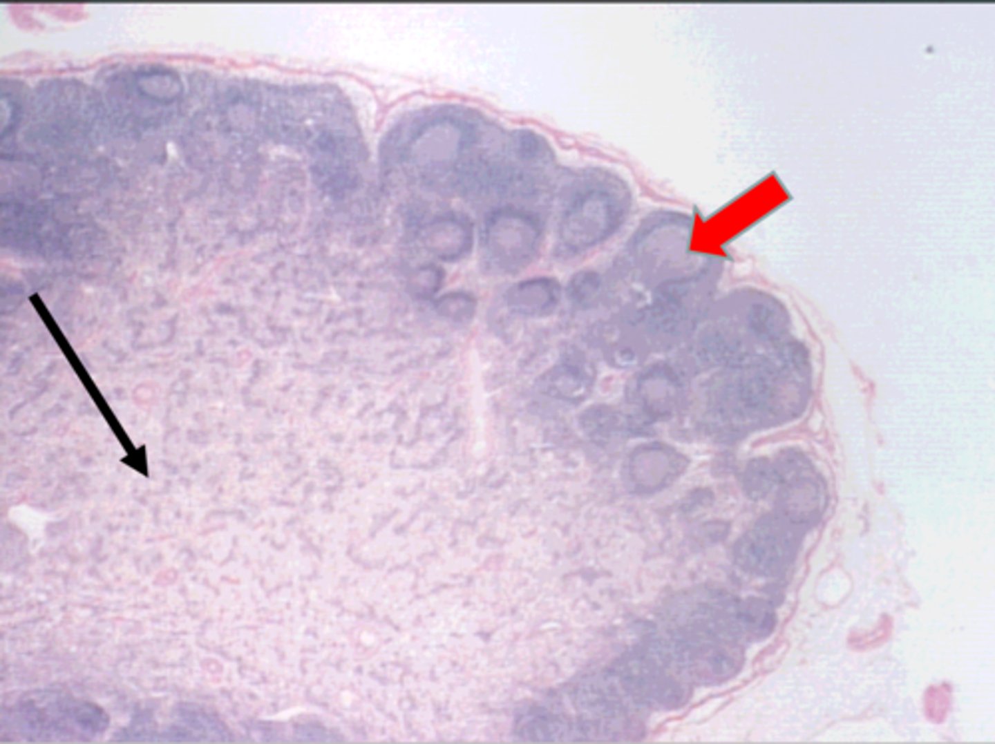 <p>red arrow</p><p>secondary lymphatic nodule</p>
