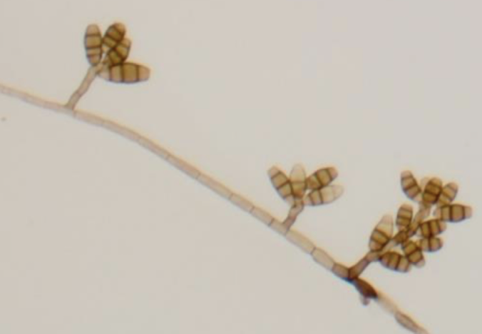 <p>Curvularia geniculata</p>