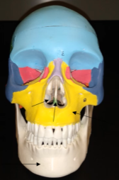 <p>What is this bone (non-color area)?</p>