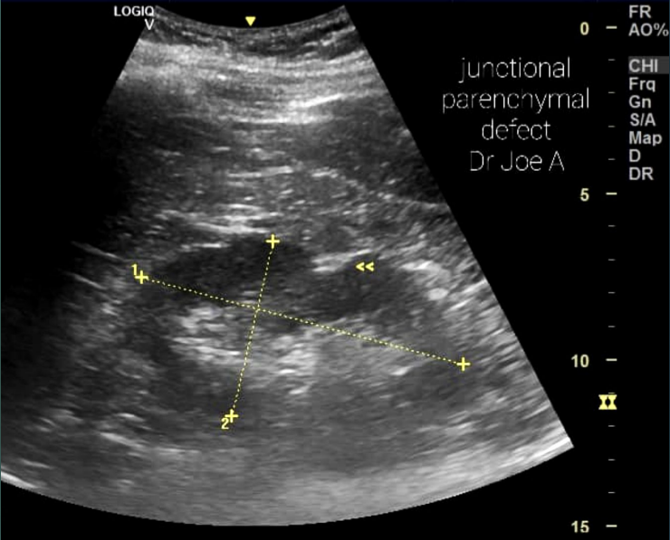 <p>What is the arrow pointing to?</p>