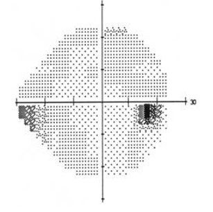 <p>what kind of defect is this </p>