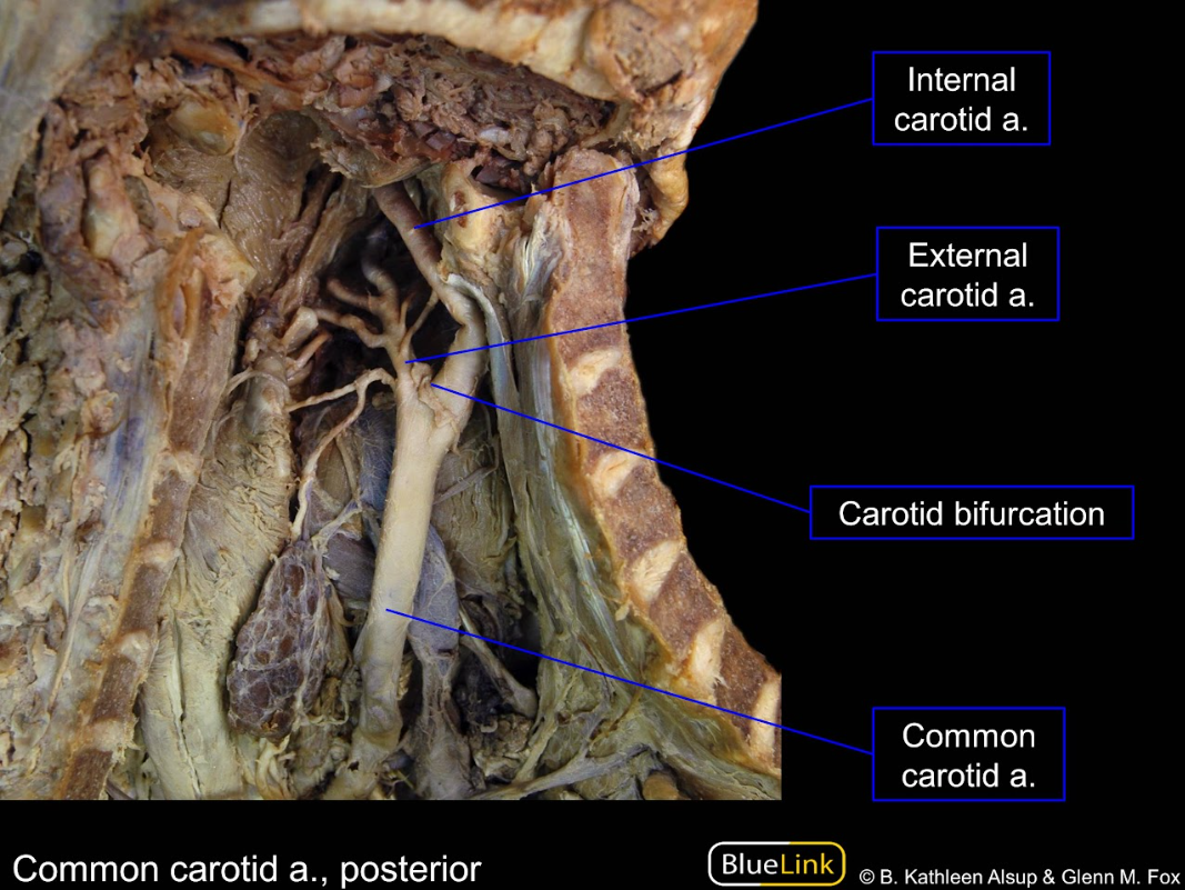 <p>Know the common carotid a.</p>
