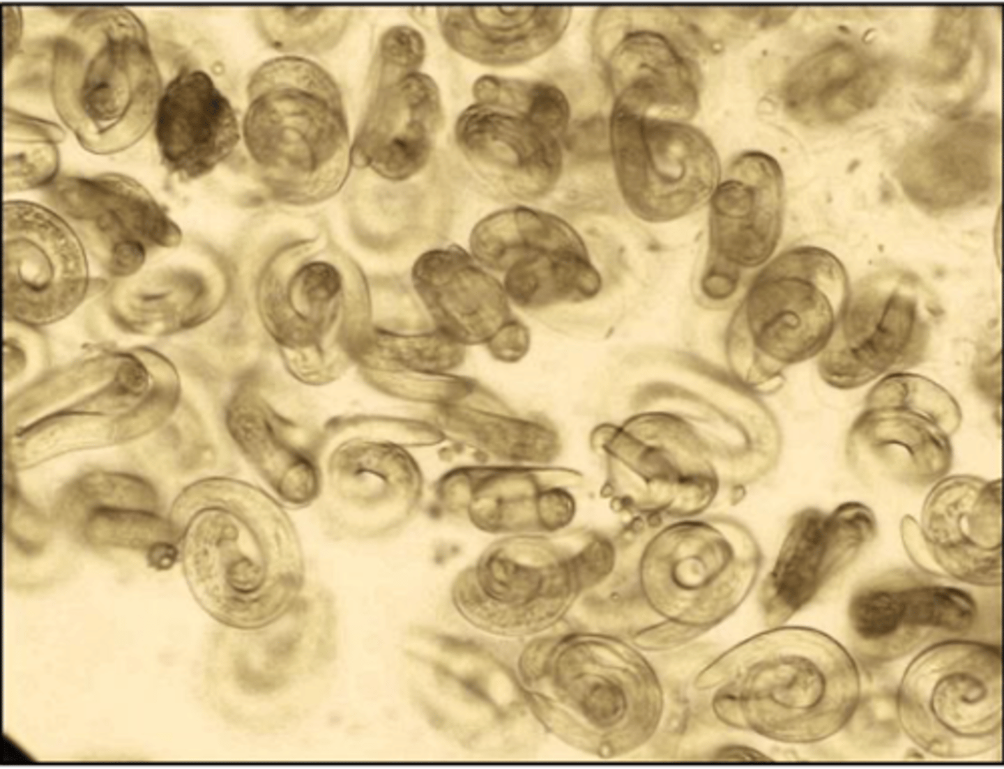 <p>Found in dog pup presenting with cough and dyspnoea with bitch presenting similarly. What parasite is this?</p>