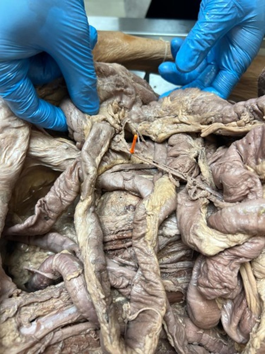 <p>right colic artery</p>