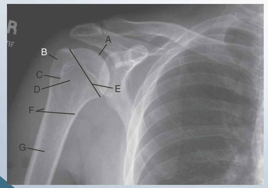 <p>AP external rotation</p><p>LABEL</p>
