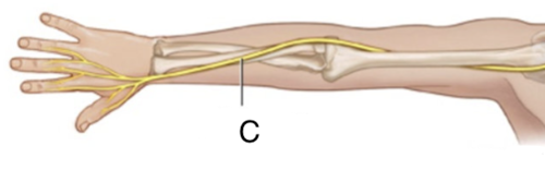 <p><span>Sensory-motor nerve that, with its branches, supplies the thumb side of the arm and back of the hand.</span></p>