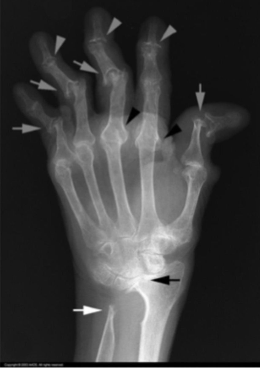 <p>What is the issue?</p>