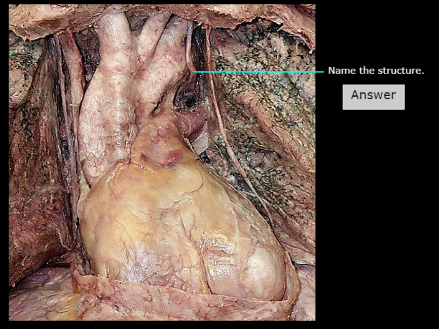 <p>What nerve is this</p>