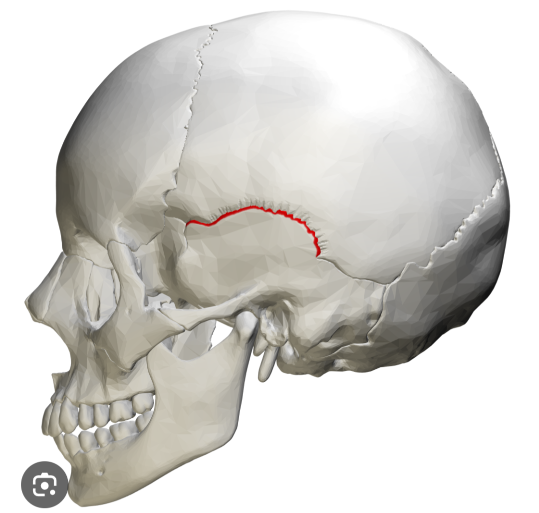 <p>What suture is this?</p>