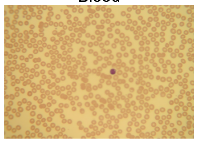 <p>red and white blood cells are unique because they are suspended in a fluid matrix</p><p>classified as CT because it derives from mesenchyme</p>
