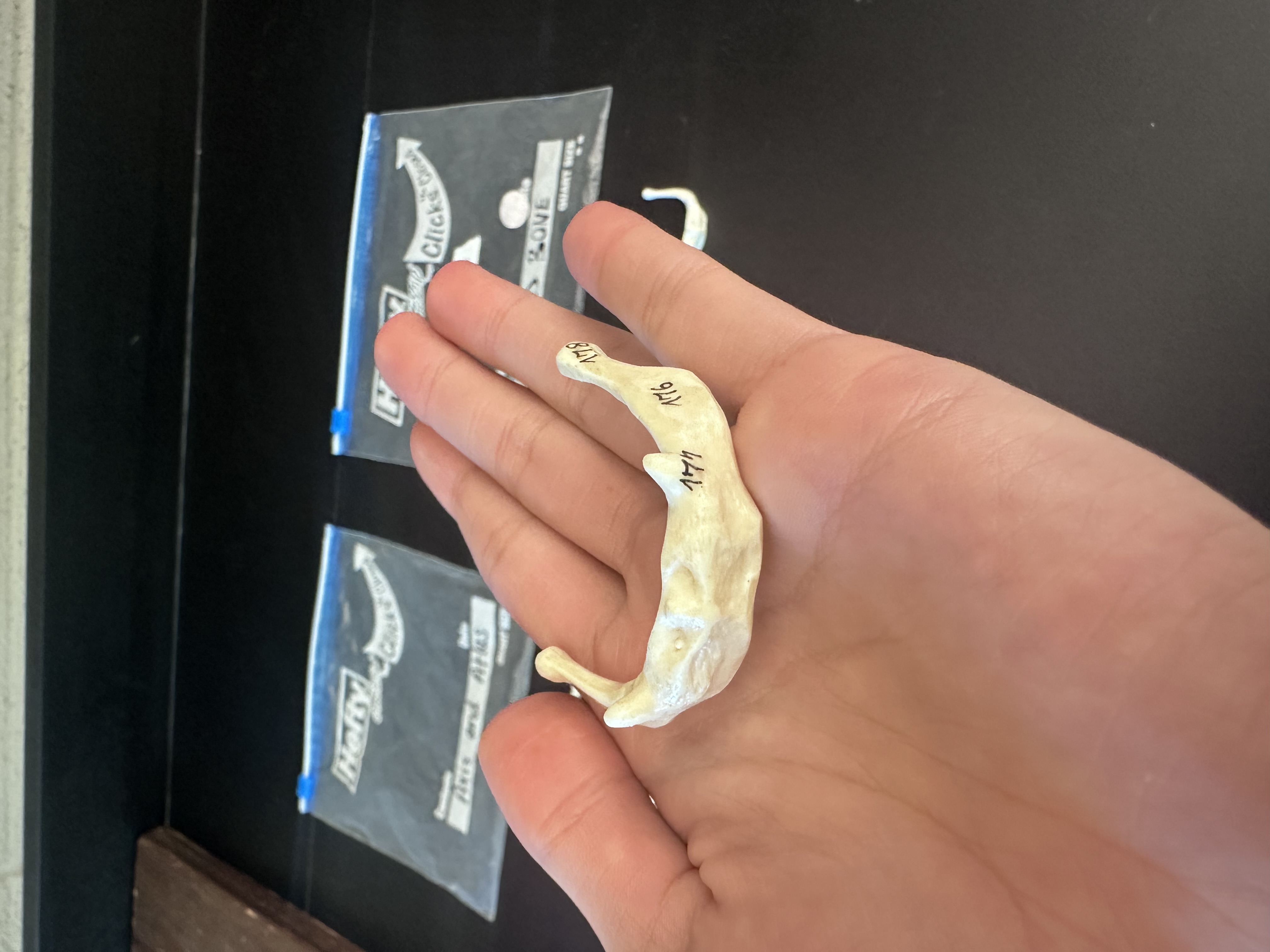 <p>Hyoid Bone</p>