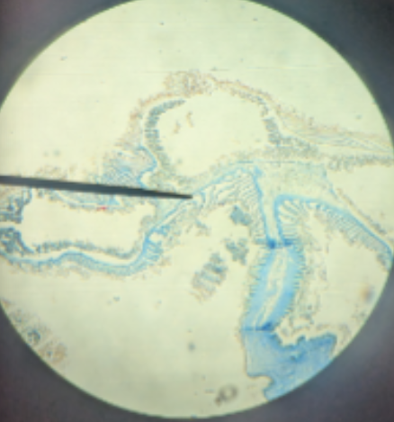<p>how does Physalia reproduce</p>