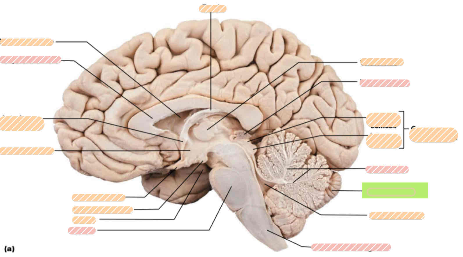 <p><span>Human brain</span></p>