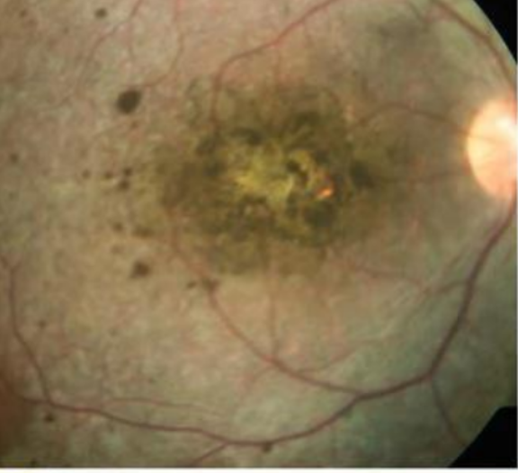 <p>examples of fusion anomalies </p>