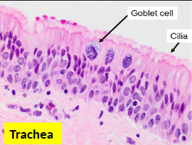 <p>what type of epithelium does the upper respiratory tract (nose, sinus, larynx) + trachea have?</p>