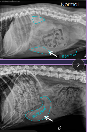 <p>Splenic Torsion “acute abdomen”</p>