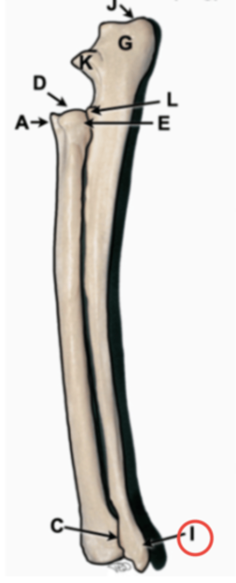 <p>distal aspect on radius that articulates with radial carpal bone</p>