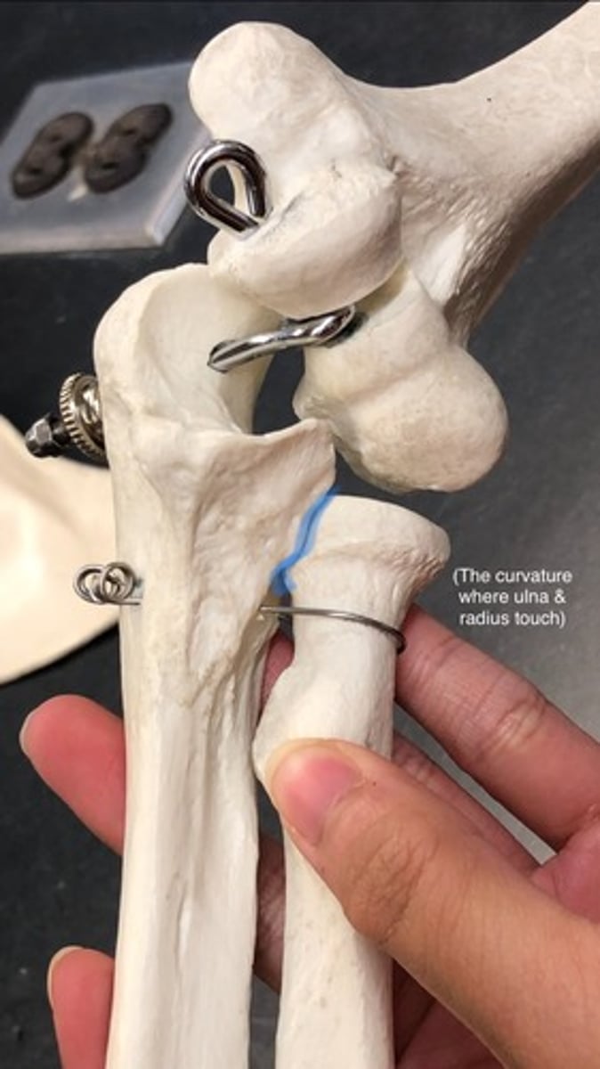 <p>lateral; side of coronoid process where radius fits in</p>