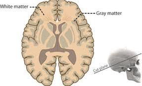 <p>What connects the two halves (cerebral hemispheres) of the Cerebrum?</p>