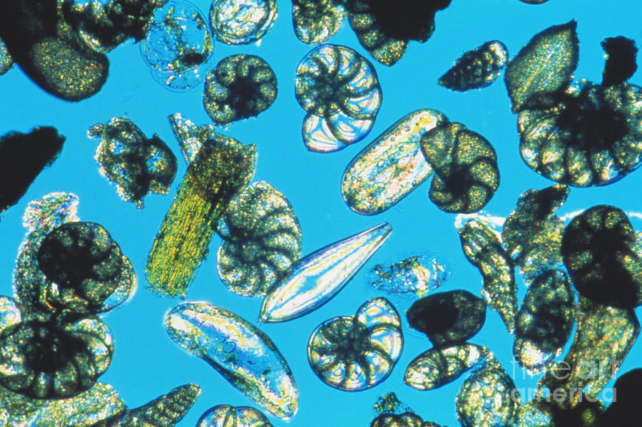 <p>Which protist is this? </p>