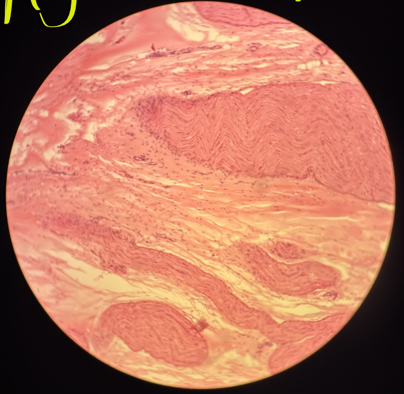 term image