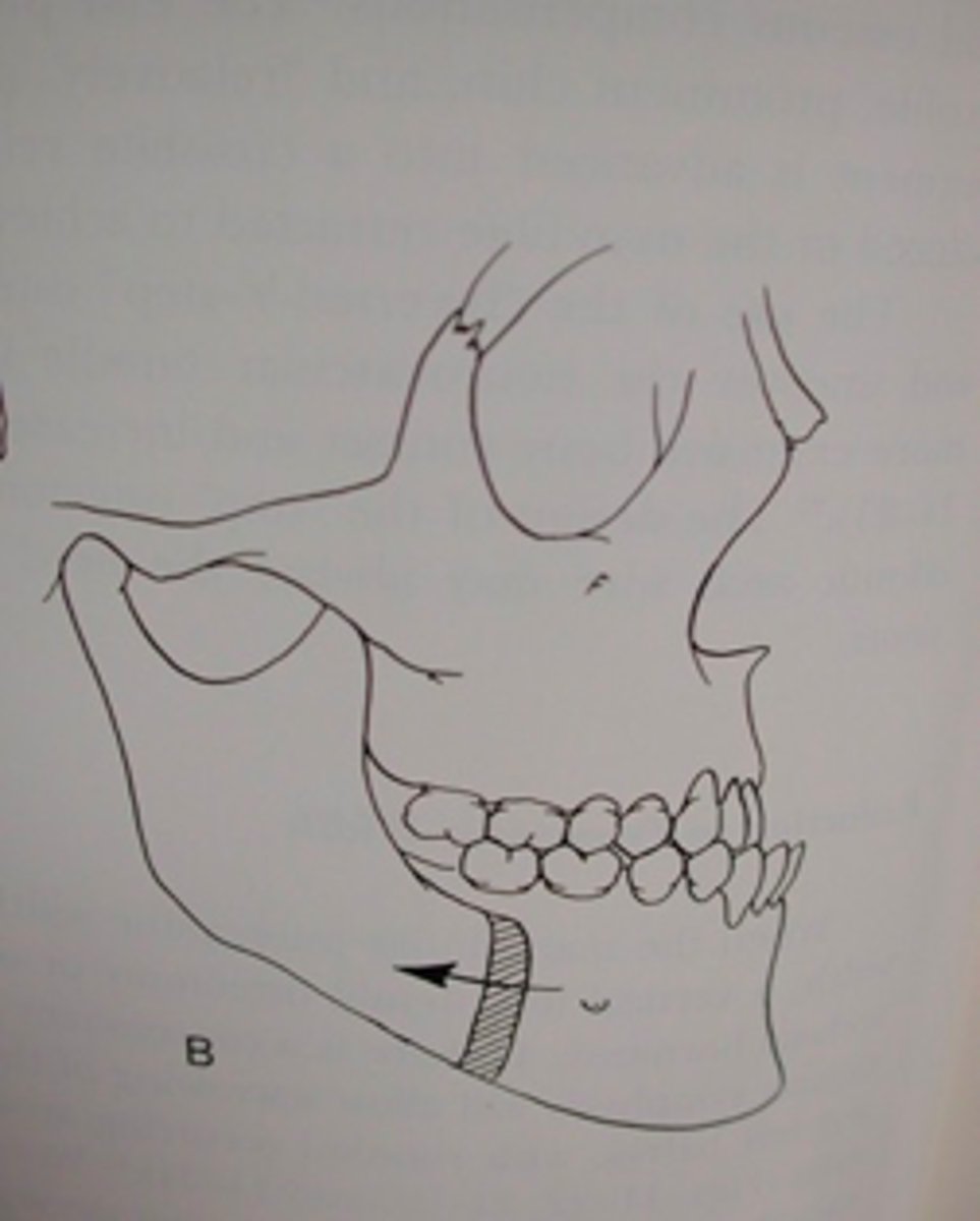 <p>ID the procedure:</p>