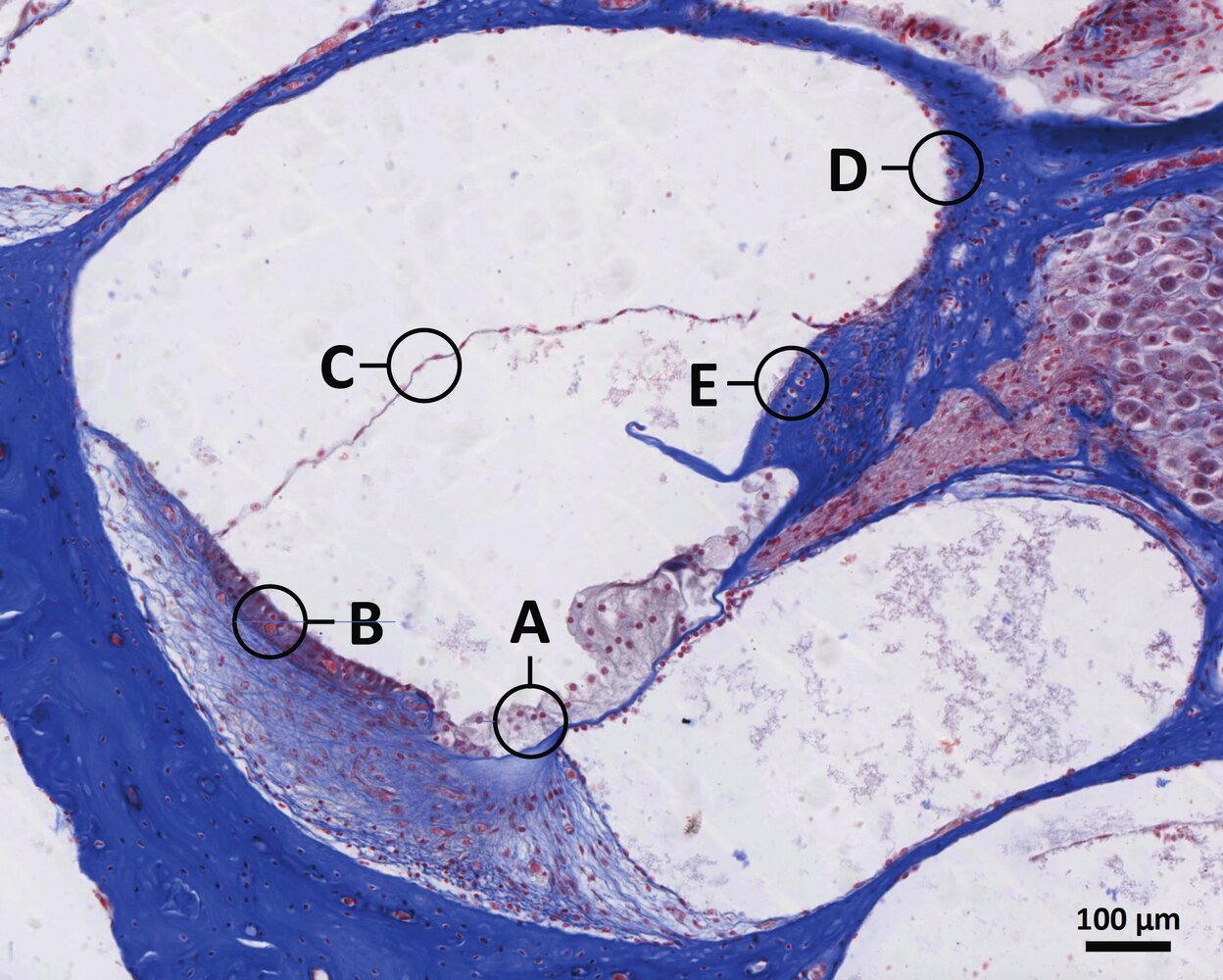 <p>65. Some loop diuretics can cause hearing impairment when used to treat high blood pressure. This side effect occurs due to inhibition of the NKCC1 transporter in cells responsible for the high potassium content of the endolymph in the cochlear duct.</p><p>Which letter in the illustration marks these cells?</p>