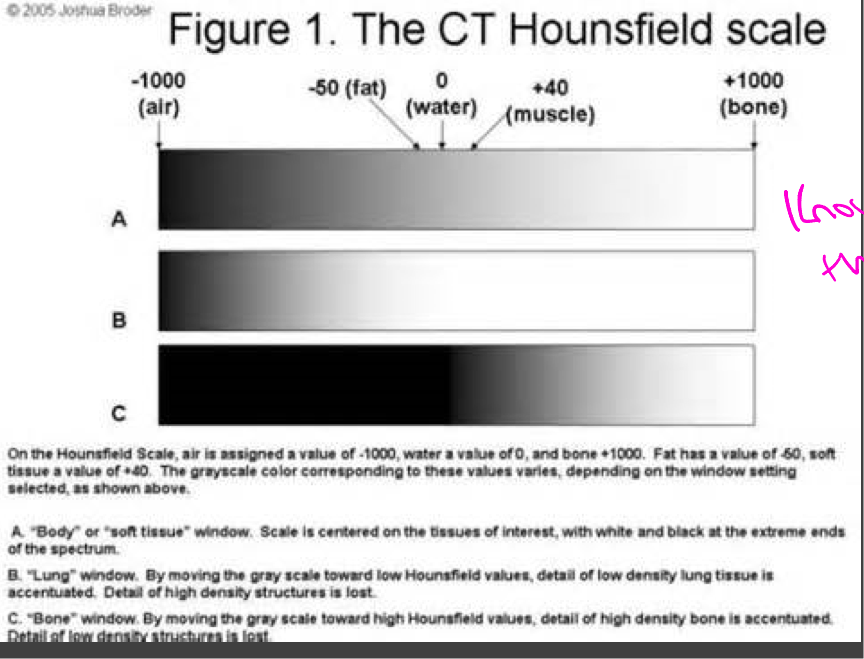 <p>CT window- range of the densities that are compressed into shades of gray for viewing</p><p>Soft tissue, bone, lung window</p>