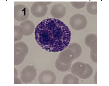 <p><span style="font-family: Helvetica; font-size: 12px;">The disease most closely associated with mucopolysaccharidosis in the lysosomes as shown here is:</span></p>