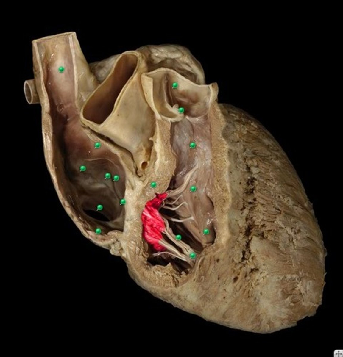 <p>between atrium and ventricle</p>