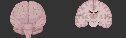 <p>What plane is this brain on?</p>