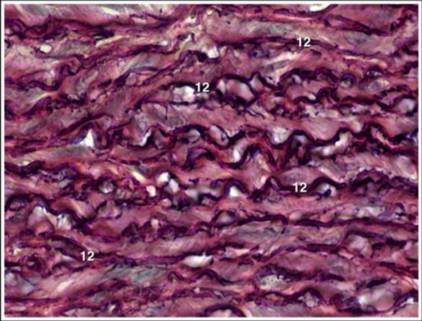 <p>stretchy and squiggly appearance; densely packed fibers</p><p>- allows recoil of tissue following stretching; maintains pulsatile flow of blood through arteries; aids passive recoil of lungs</p><p>- located in walls of large arteries; within certain ligaments associated with vertebral column, within the walls of the bronchial tubes</p>