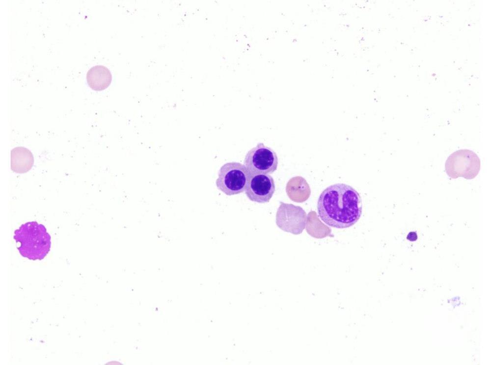 <ul><li><p>10-15 u</p></li><li><p>lower N:C ratio</p></li><li><p>very coarse chromatin</p></li><li><p>oink cytoplasm with blue tint</p></li><li><p>no granules</p></li></ul><p></p>