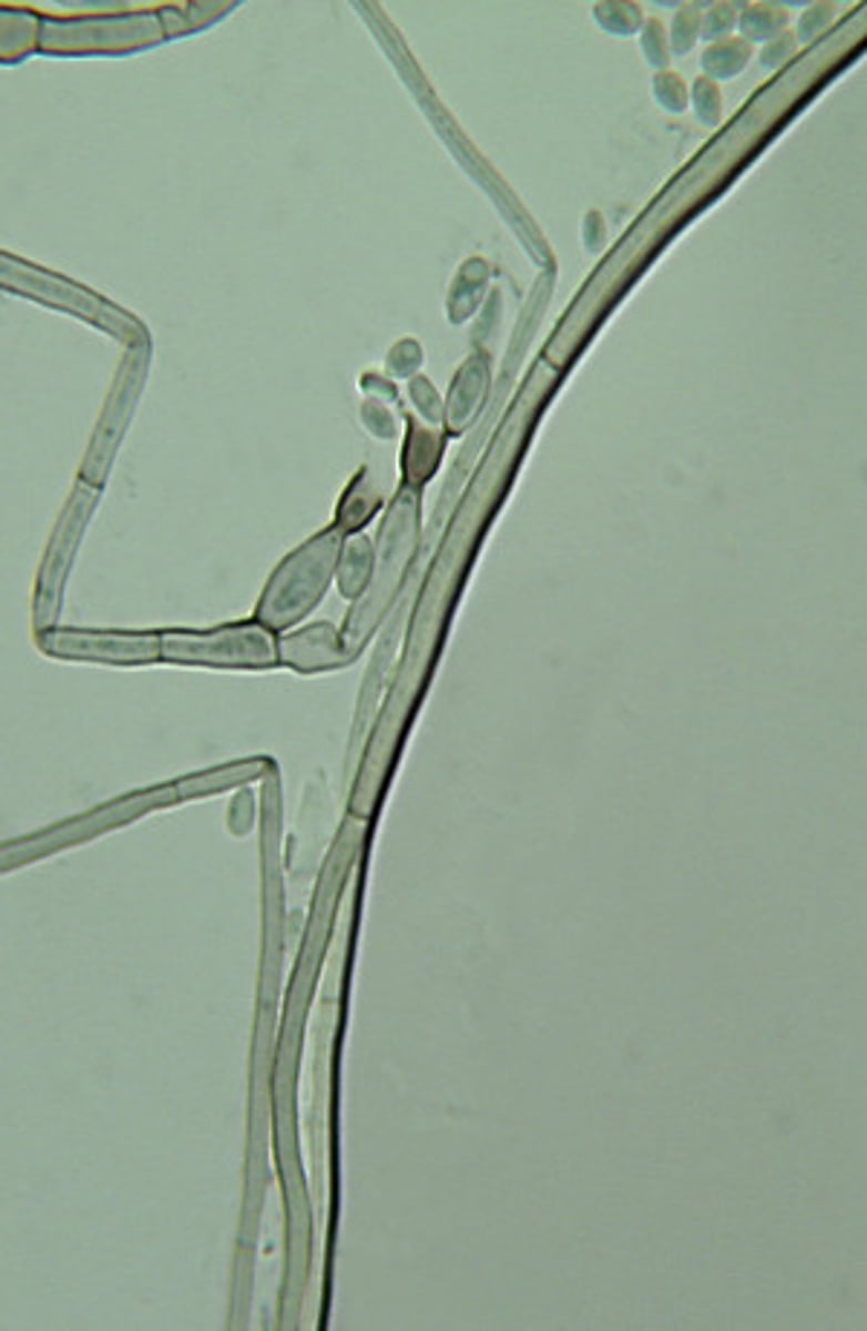 <p>Phialophora verrucosa produces vase-like phialides with cup-shaped collarettes that form oval conidia.</p>