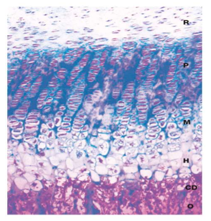 <ul><li><p>Zone of reserve cartilage ( R)</p></li><li><p>Zone of proliferation (P)</p></li><li><p>Zone of maturation (M)</p></li><li><p>Zone of hypertrophy and calcification ( H)</p></li><li><p>Zone of cartilage degeneration (CD)</p></li><li><p>Osteogenic zone (O)<br></p></li></ul><p><strong><em><u>Secondary Ossification Center</u></em></strong></p><ul><li><p><strong>Shortly after birth</strong>, develops in <u>proximal </u>epiphysis. </p></li><li><p>only cartilage = <strong>articular cartilage </strong>at end of long bones and as <strong>transverse disc of cartilage </strong>known as the <strong><em><u>epiphyseal growth plate</u></em></strong></p><ul><li><p>responsible for maintaining the growth process</p></li></ul></li></ul><p></p><p></p><p></p><p></p>