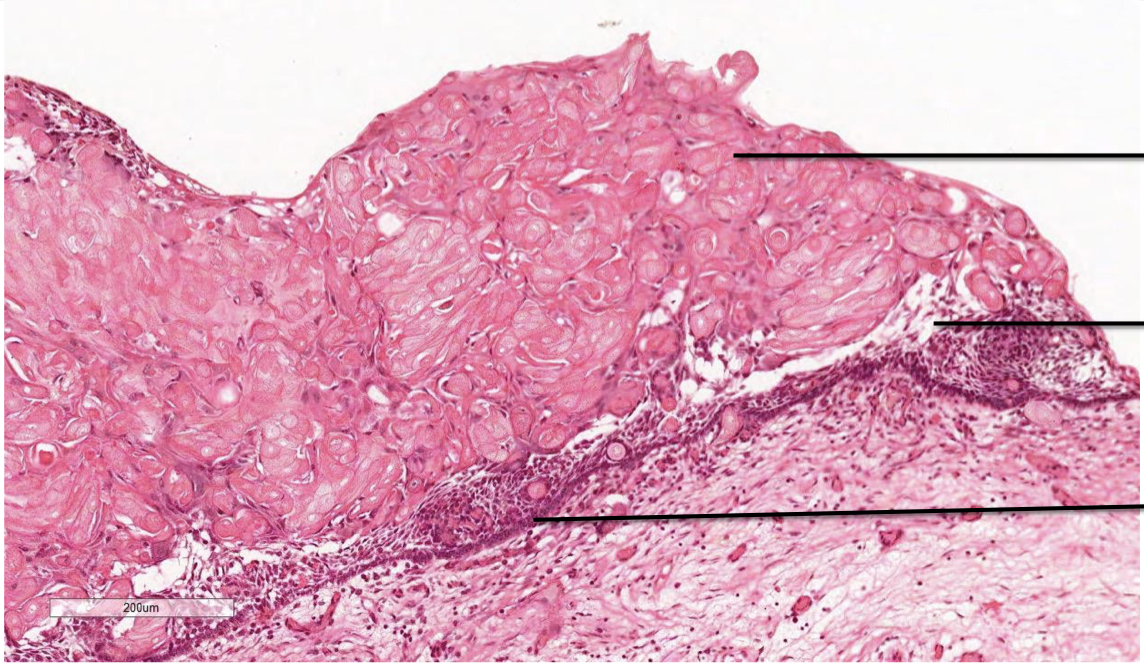 <p>Label top to bottom and name the disease</p>